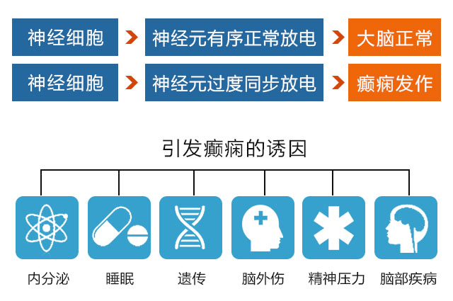 癲癇病的最新治療，探索與突破